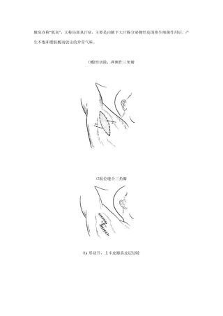 腋臭手术进展