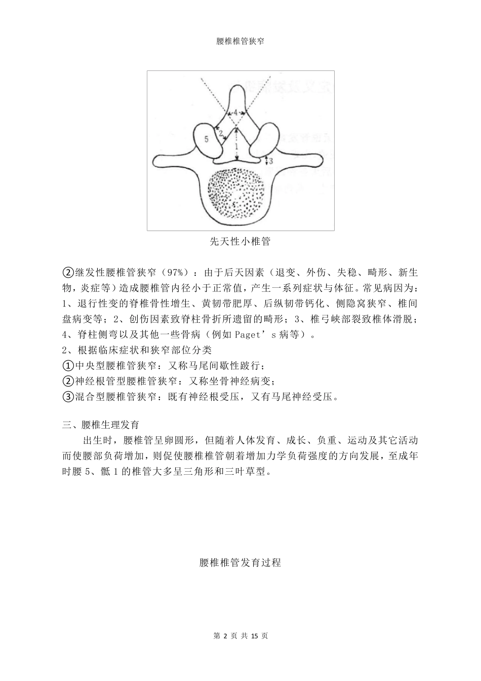 腰椎椎管狭窄_第2页