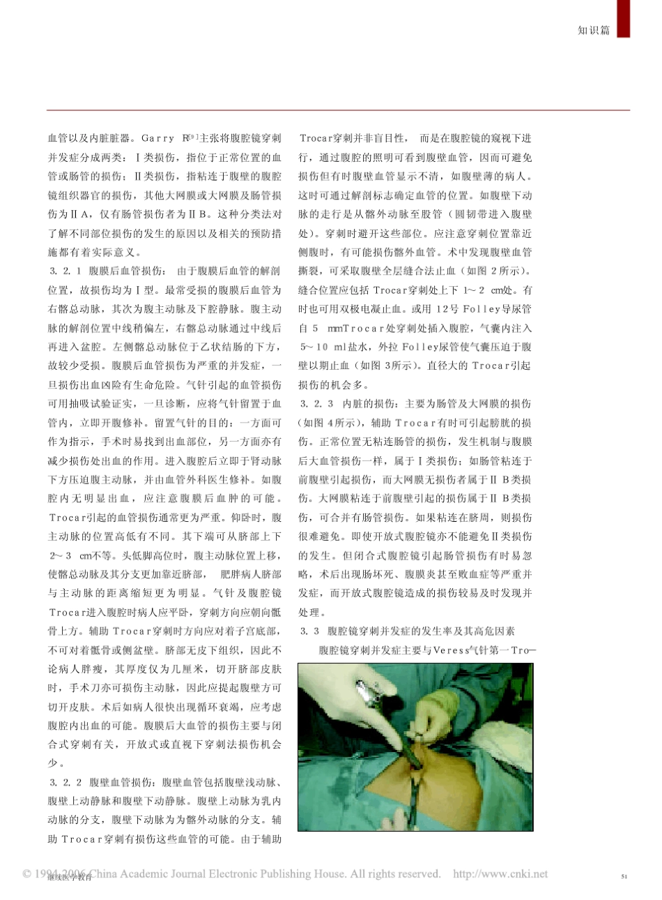 腹腔镜手术的并发症以及预防措施_第2页