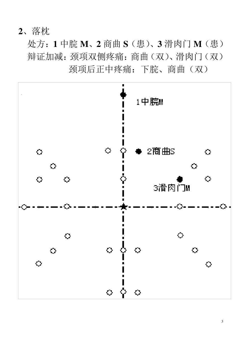 腹针常用处方(16个定稿)_第3页