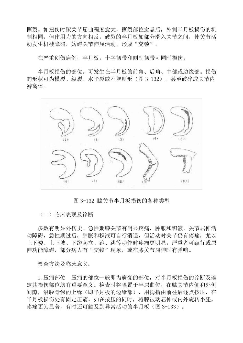 膝关节常见损伤_第2页