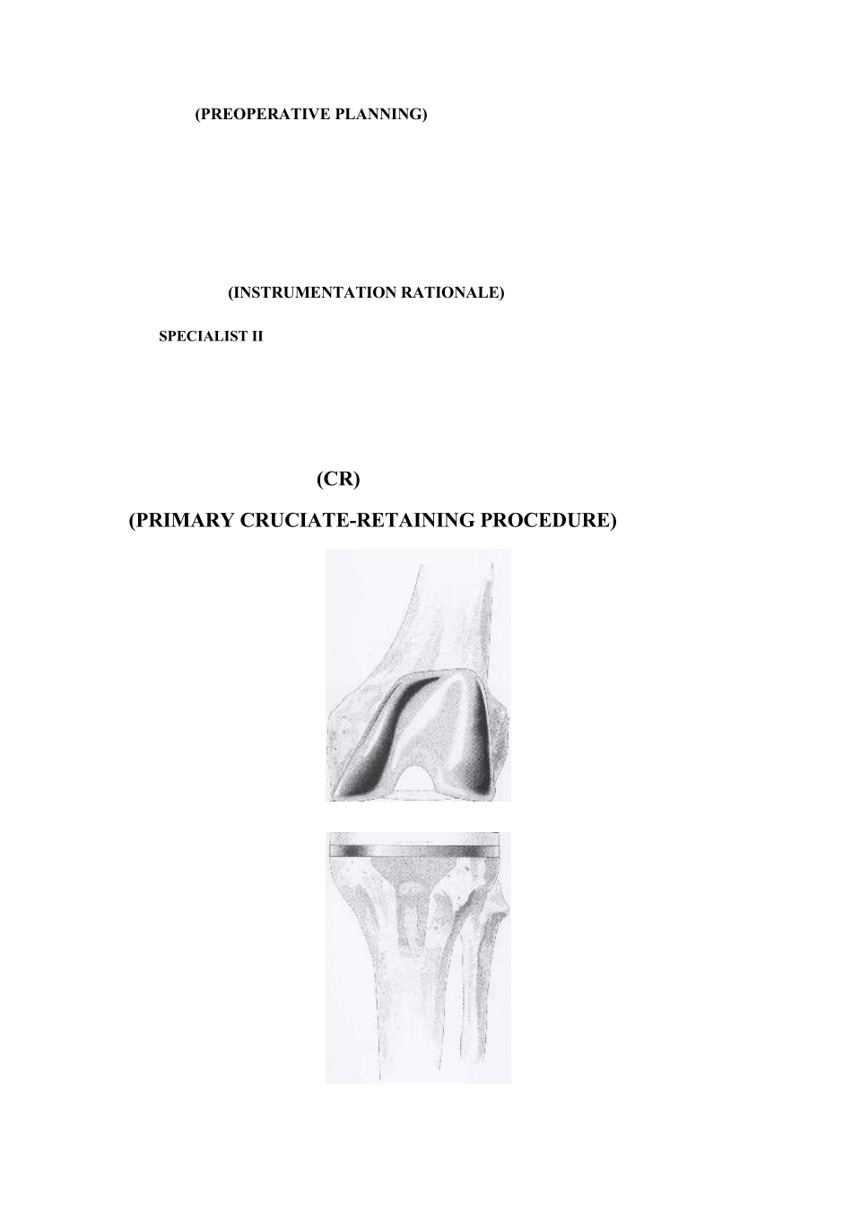 膝关节置换手册(强生版)_第2页