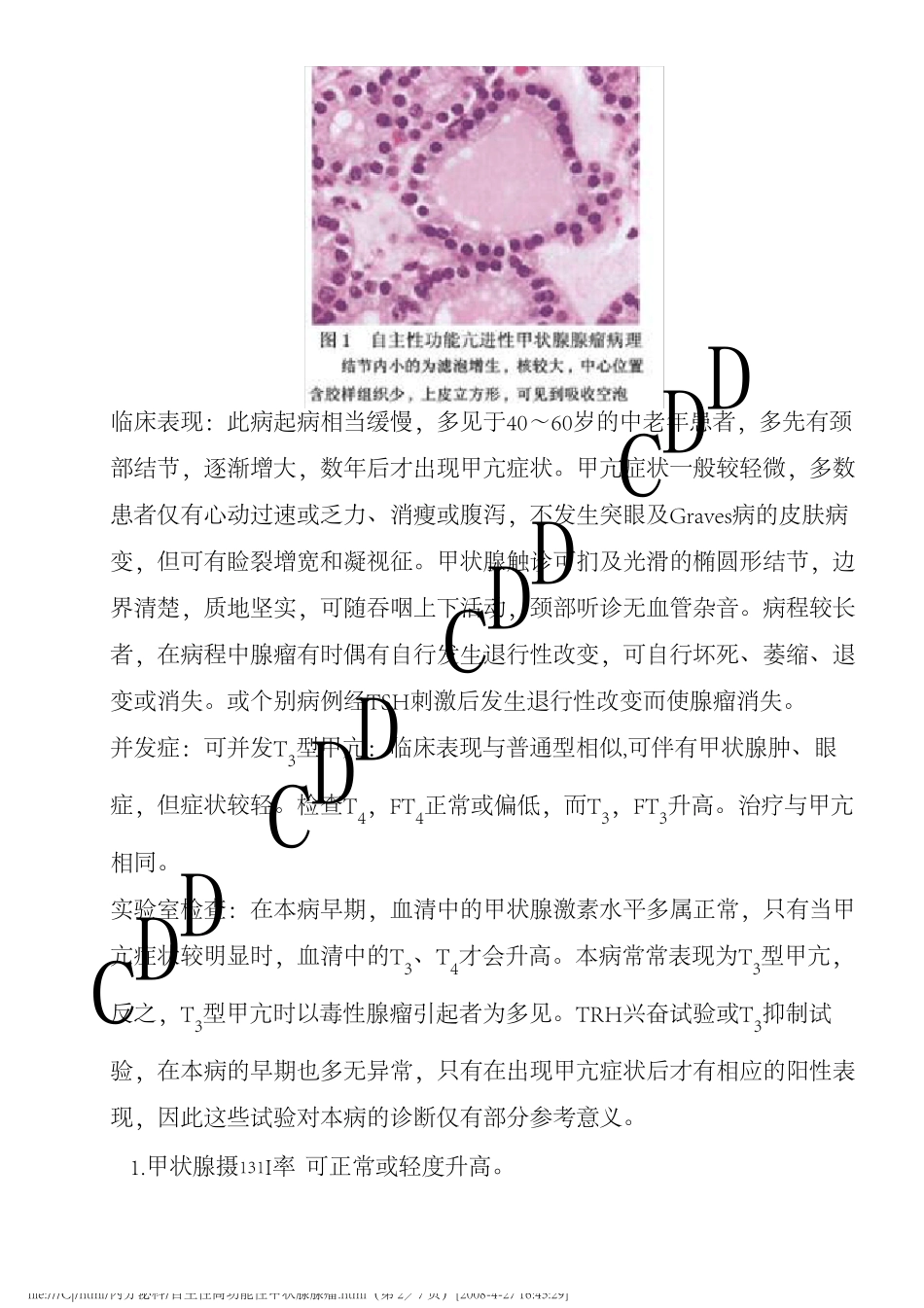 自主性高功能性甲状腺腺瘤_第2页