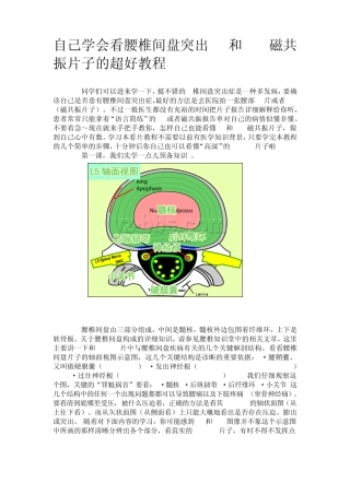 自己学会看腰椎间盘突出CT和MRI磁共振片子的超好教程