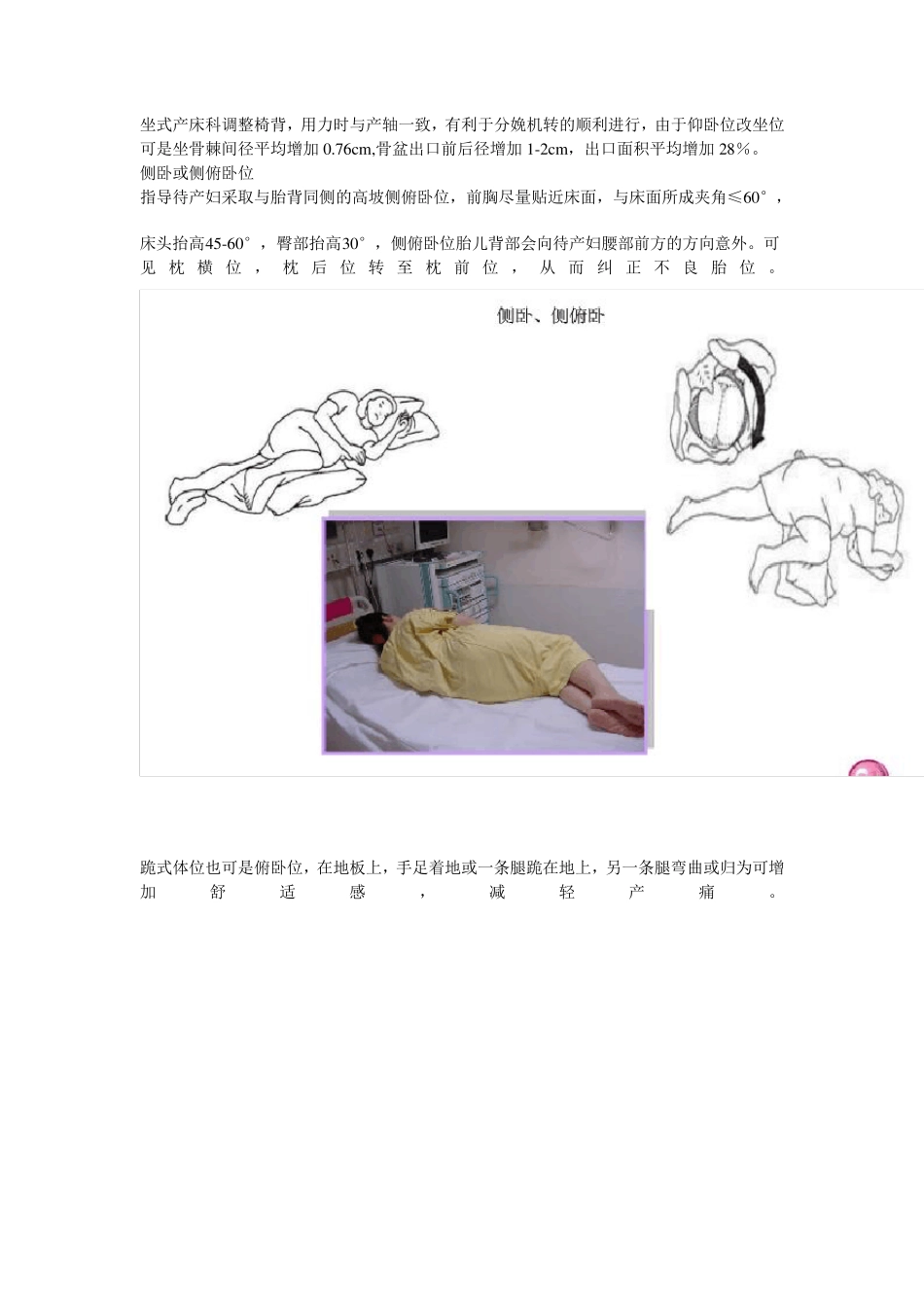 自由体位分娩_第2页