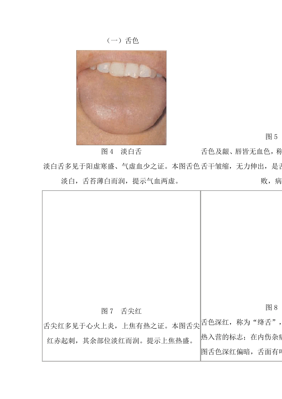 舌苔望诊图谱集_第2页