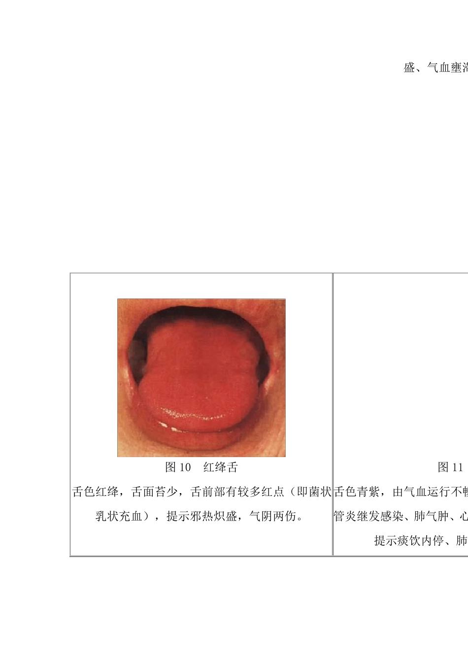 舌苔望诊图谱集_第3页