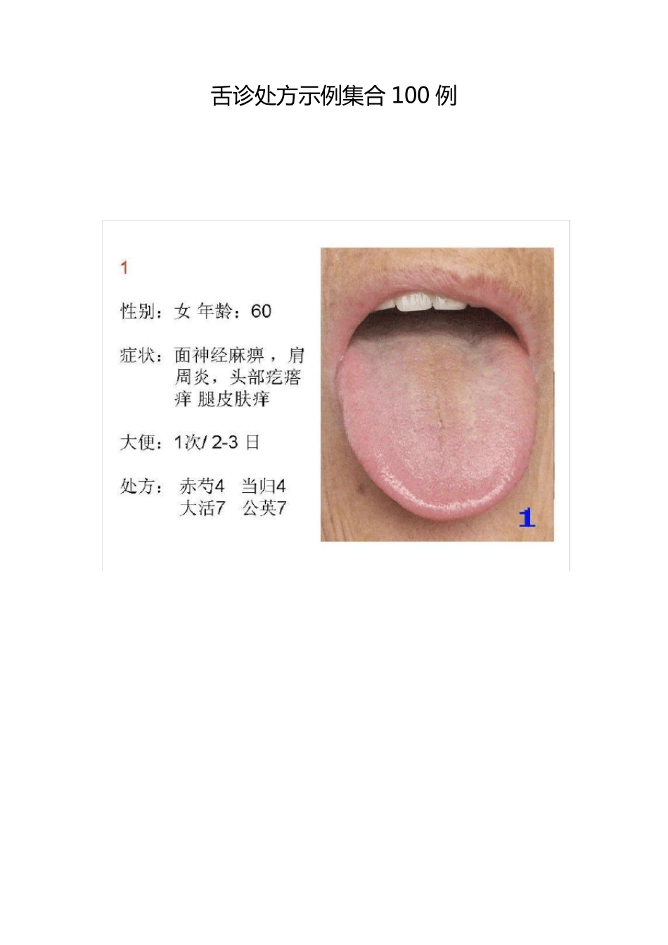 舌诊处方示例集合100例_第1页