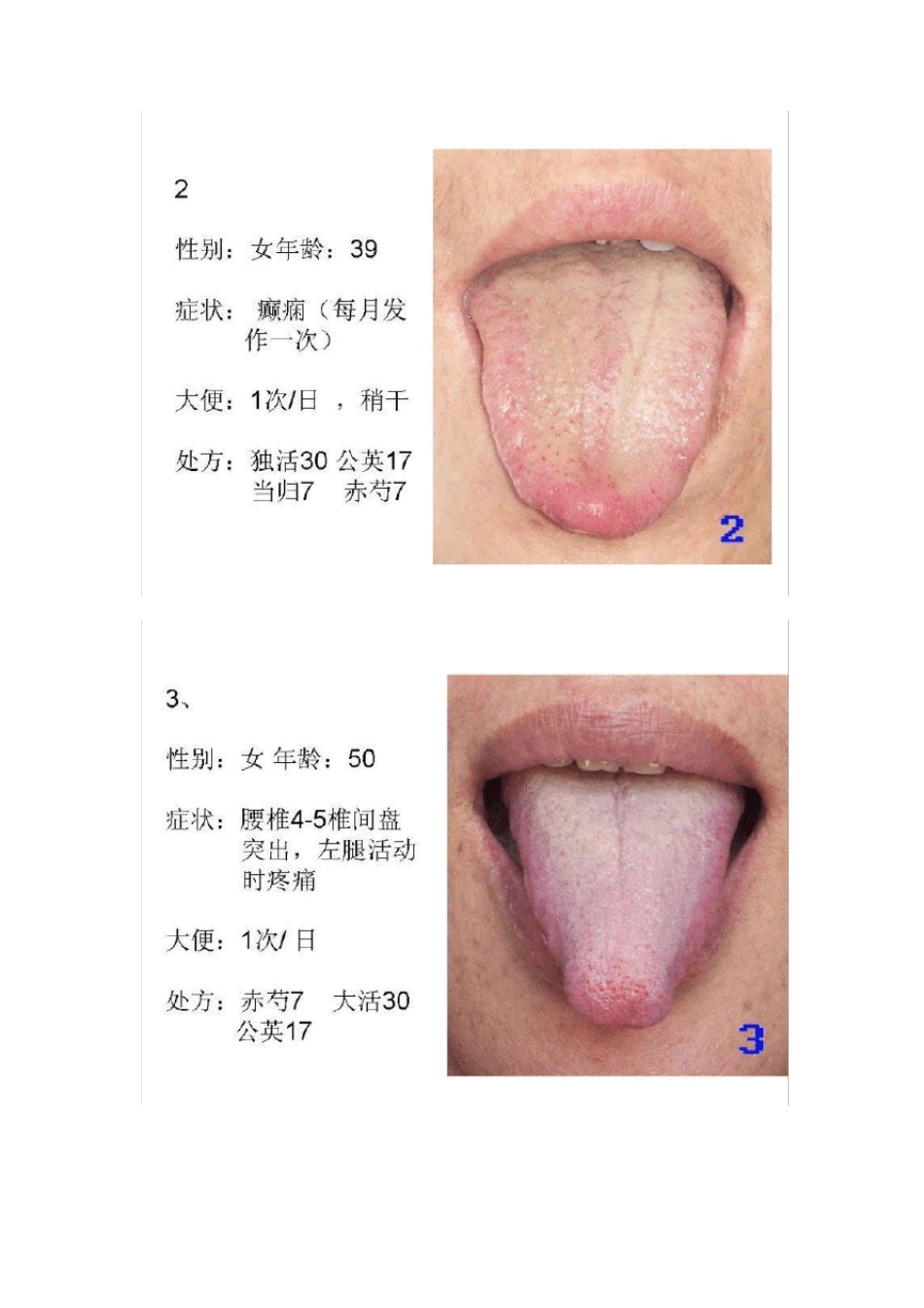 舌诊处方示例集合100例_第2页