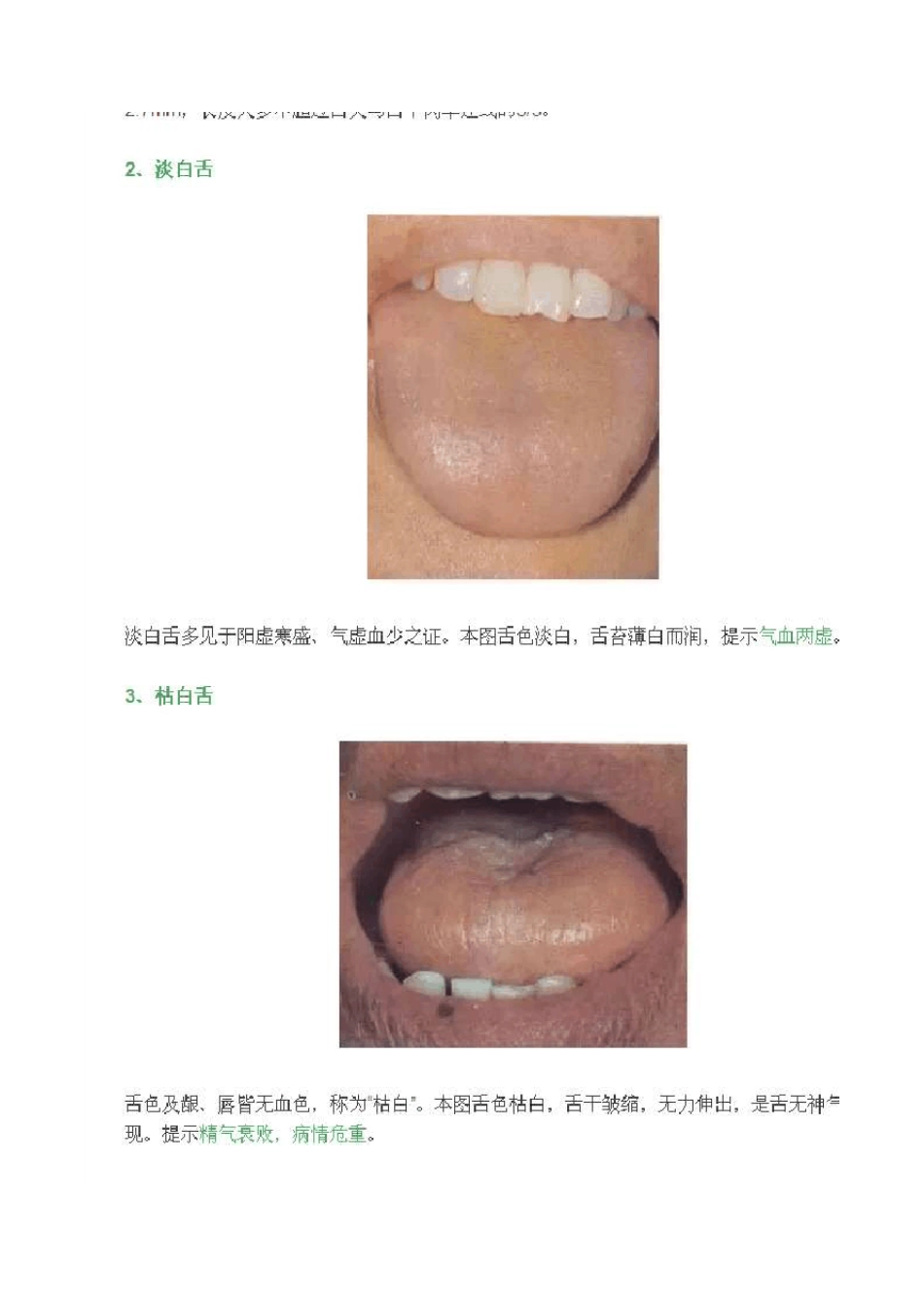 舌诊高清彩色图谱大全_第3页