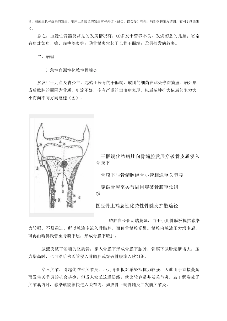 第十一章 化脓性骨髓炎与化脓性关节炎_第2页
