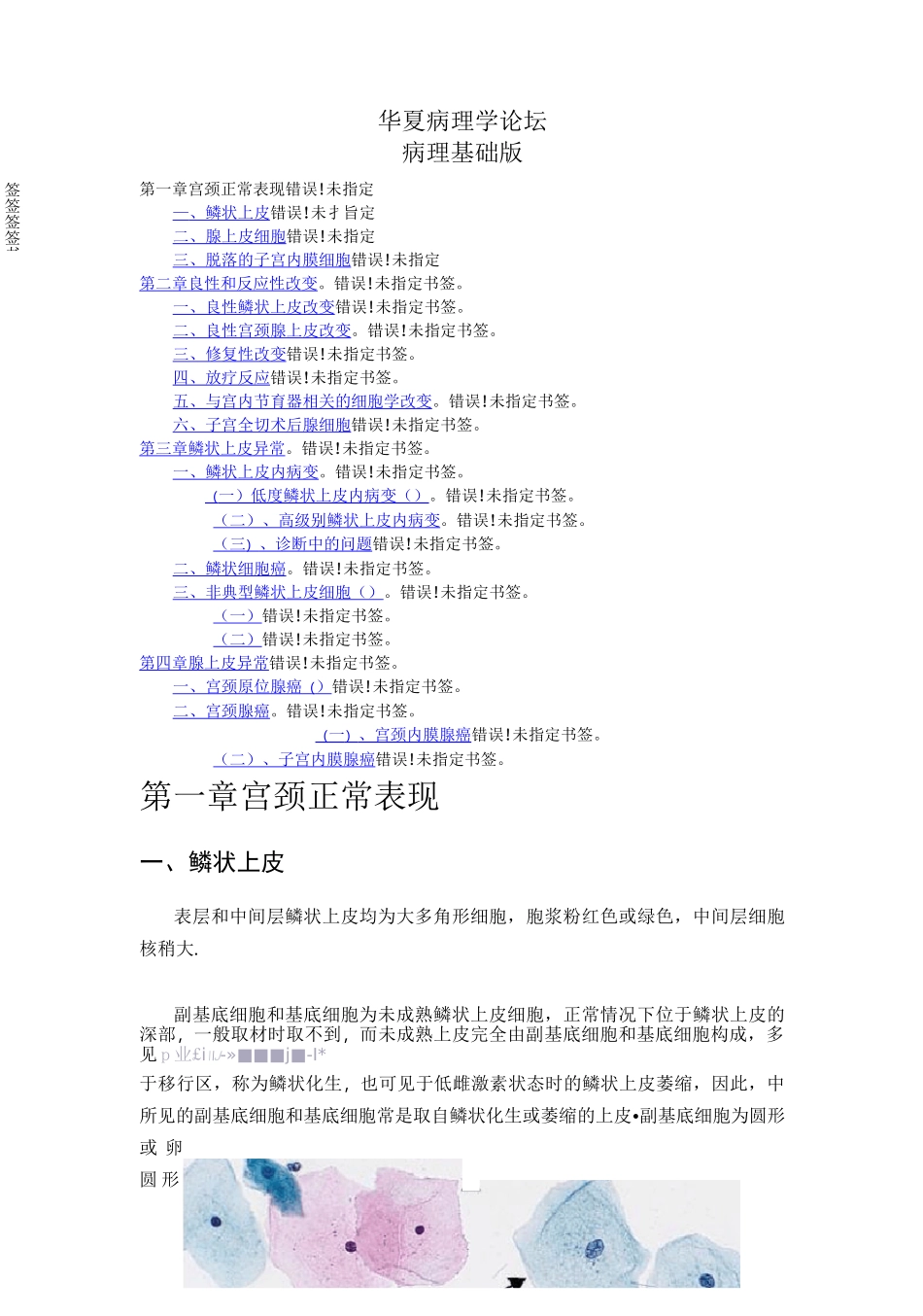 宫颈液基细胞学_第1页