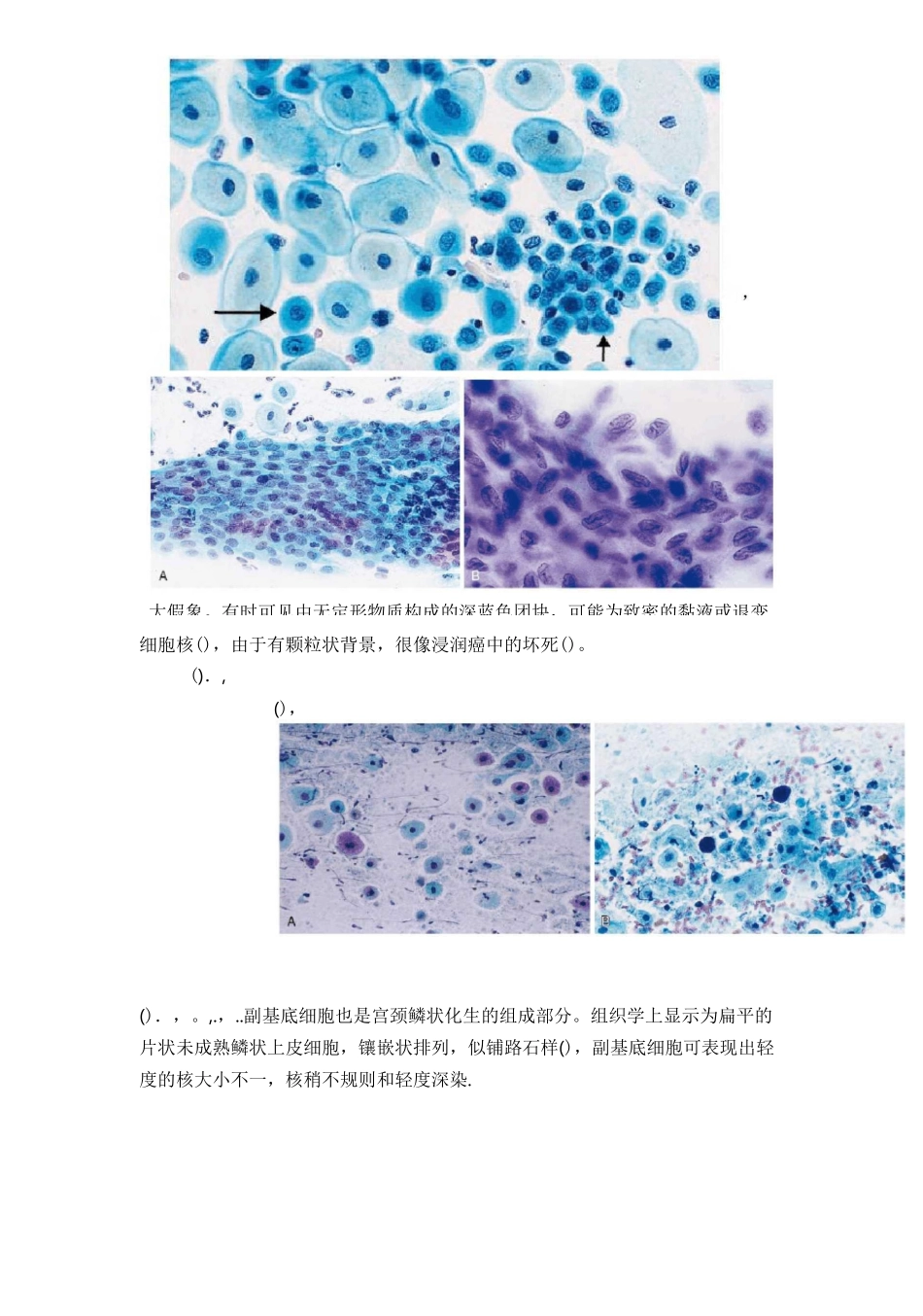 宫颈液基细胞学_第3页