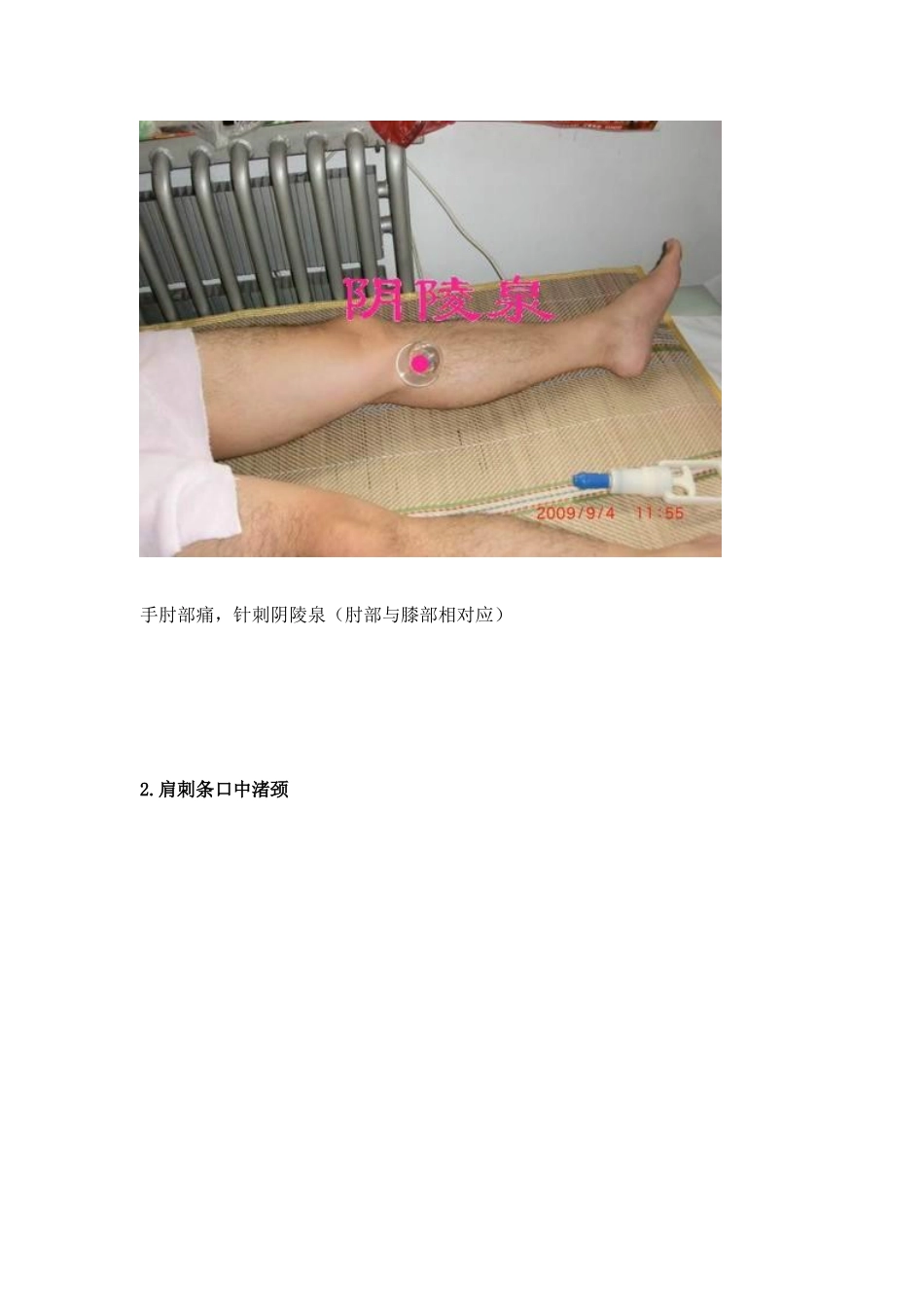 各种疼痛的针灸治疗穴位《配图片》超好用哦_第3页