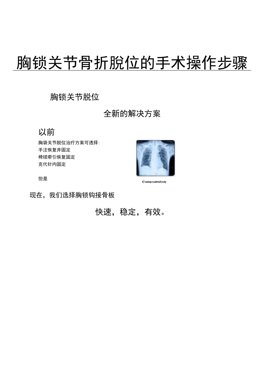 胸锁关节骨折脱位手术操作步骤(附件)_第1页