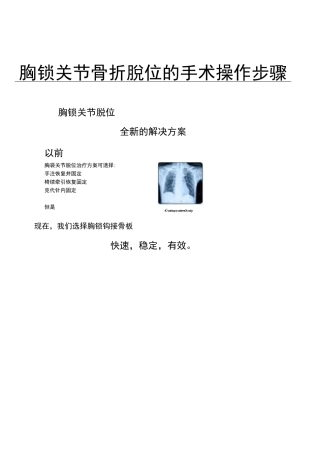 胸锁关节骨折脱位手术操作步骤(附件)