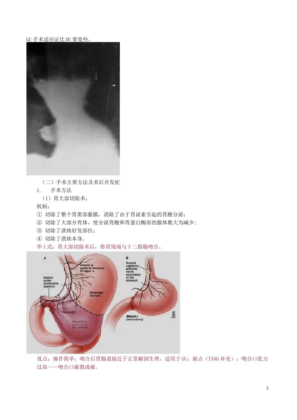 胃、十二指肠疾病_第2页
