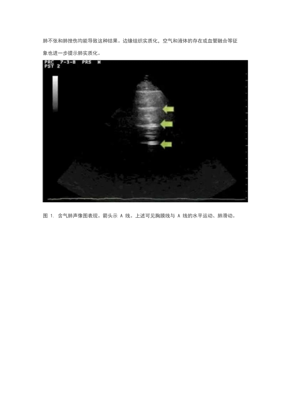 手把手教程：肺部超声检查_第2页