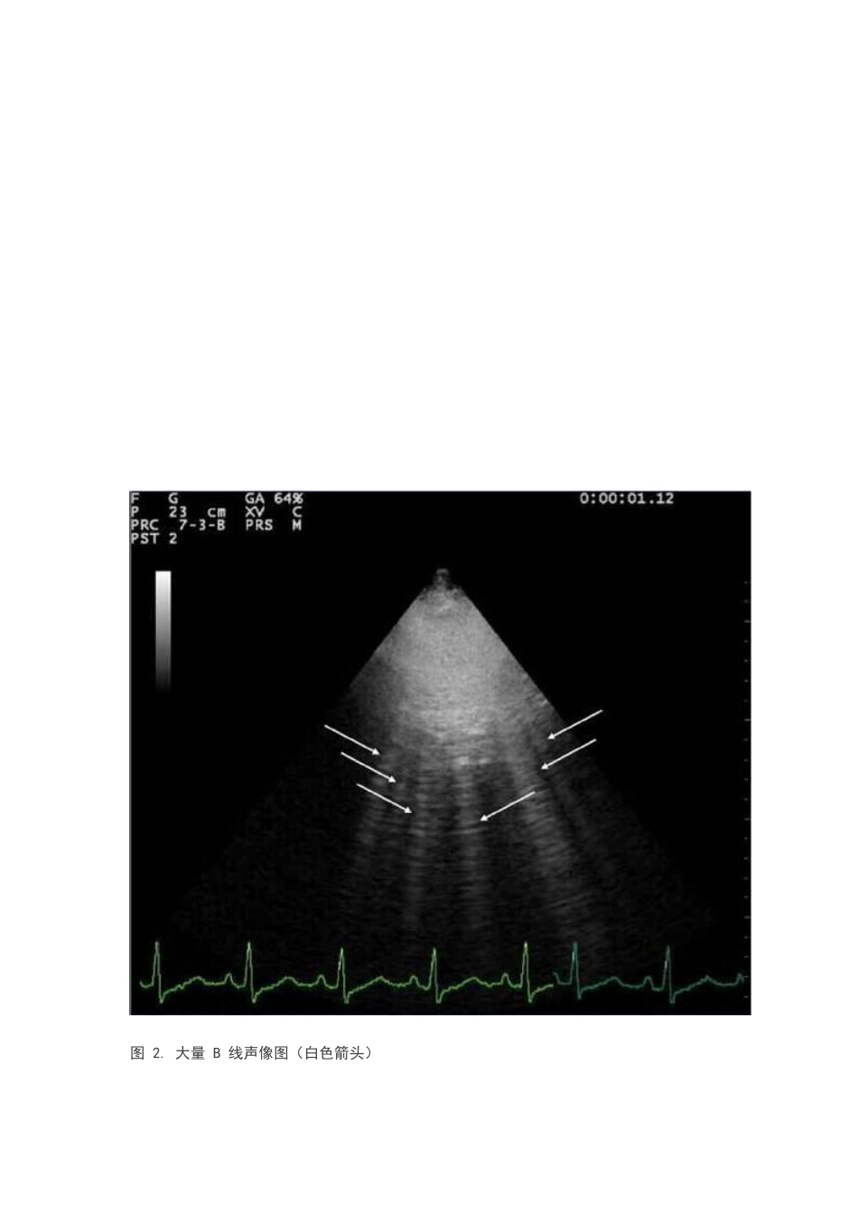 手把手教程：肺部超声检查_第3页