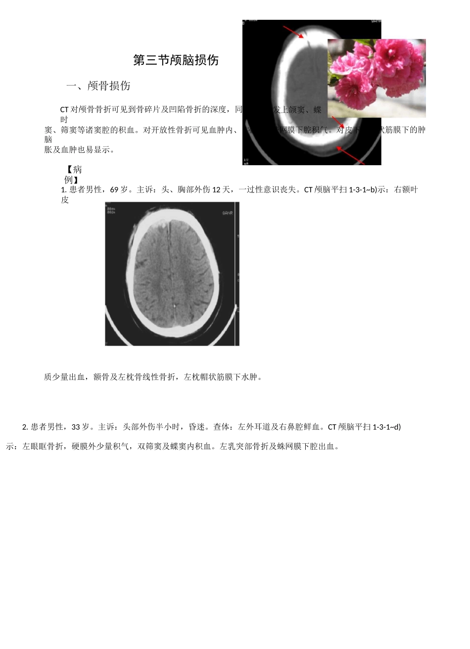 CT典型病例_第1页