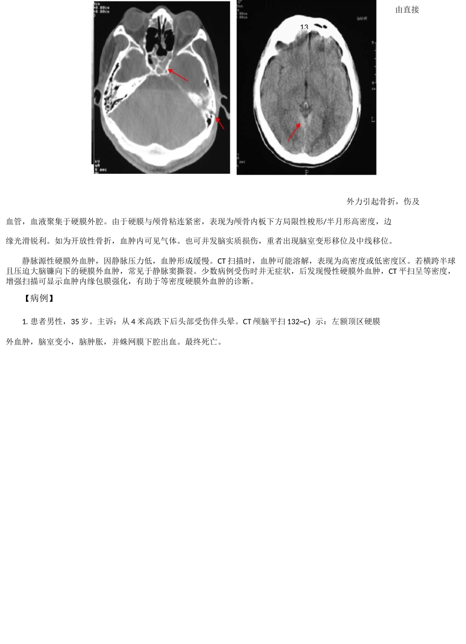 CT典型病例_第2页