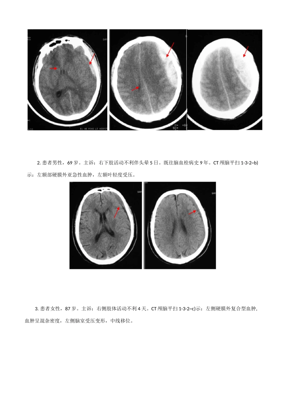 CT典型病例_第3页