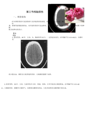 CT典型病例