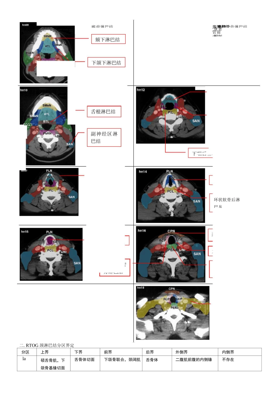 淋巴结(头颈胸分区整理)图示_第2页