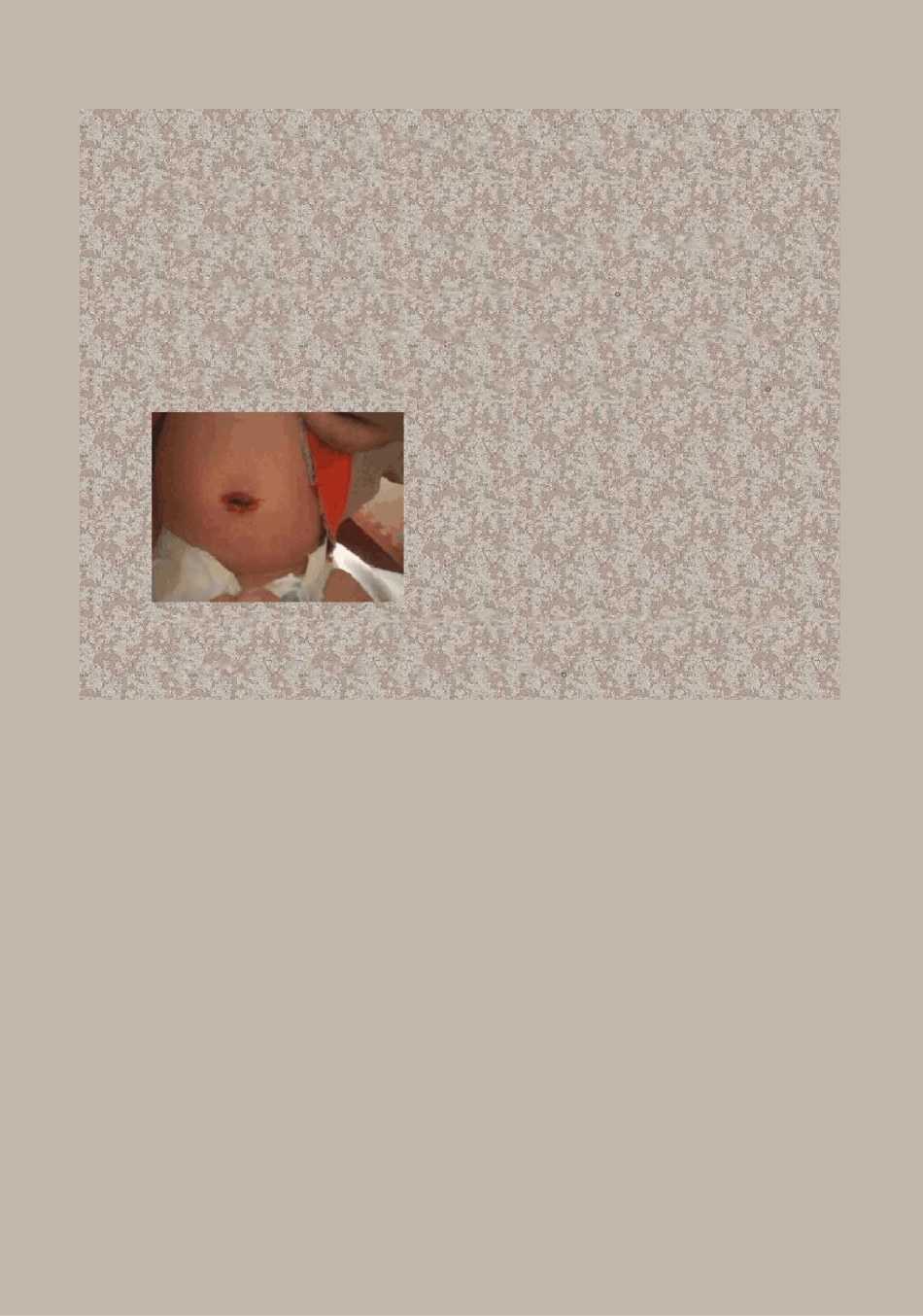 (完整版)新生儿科健康宣教_第1页