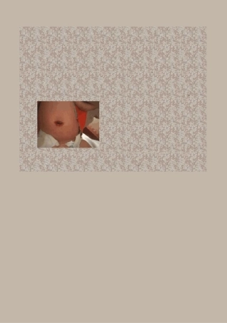 (完整版)新生儿科健康宣教