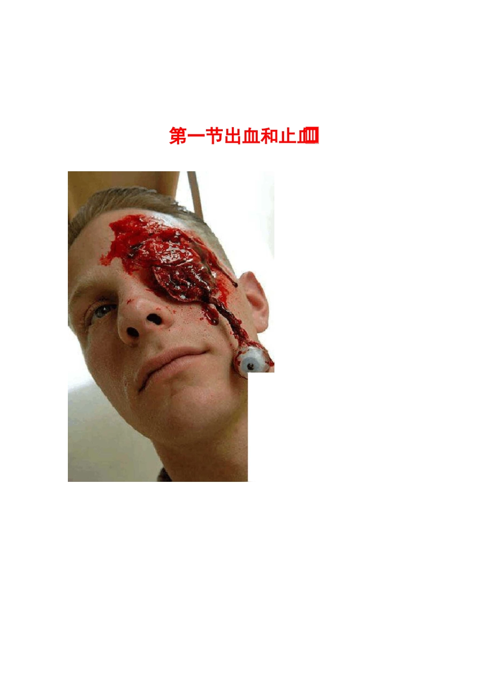 战场救护卫生课e_第2页