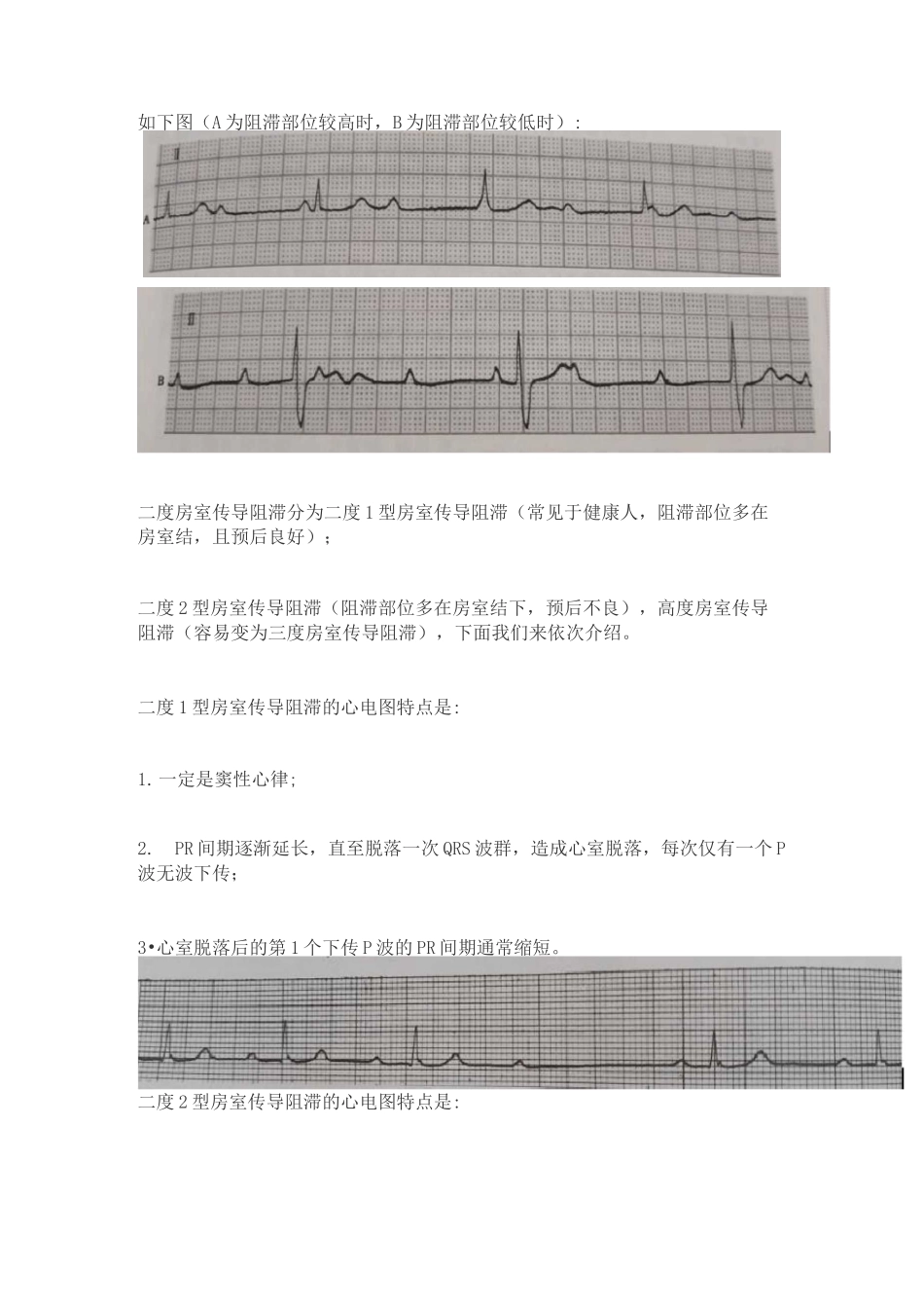 常见异常心电图(附详解图片)_第3页