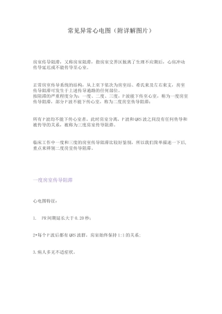 常见异常心电图(附详解图片)