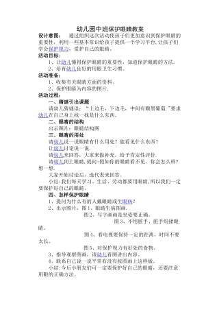 幼儿园保护眼睛教案