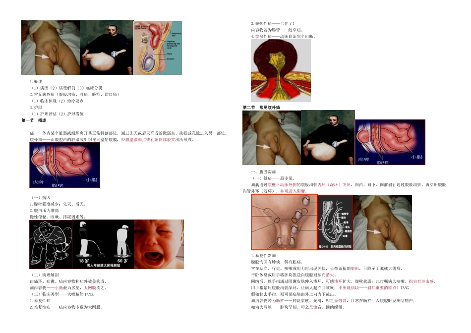 2025年主管护师外科讲义腹外疝病人的护理_第1页