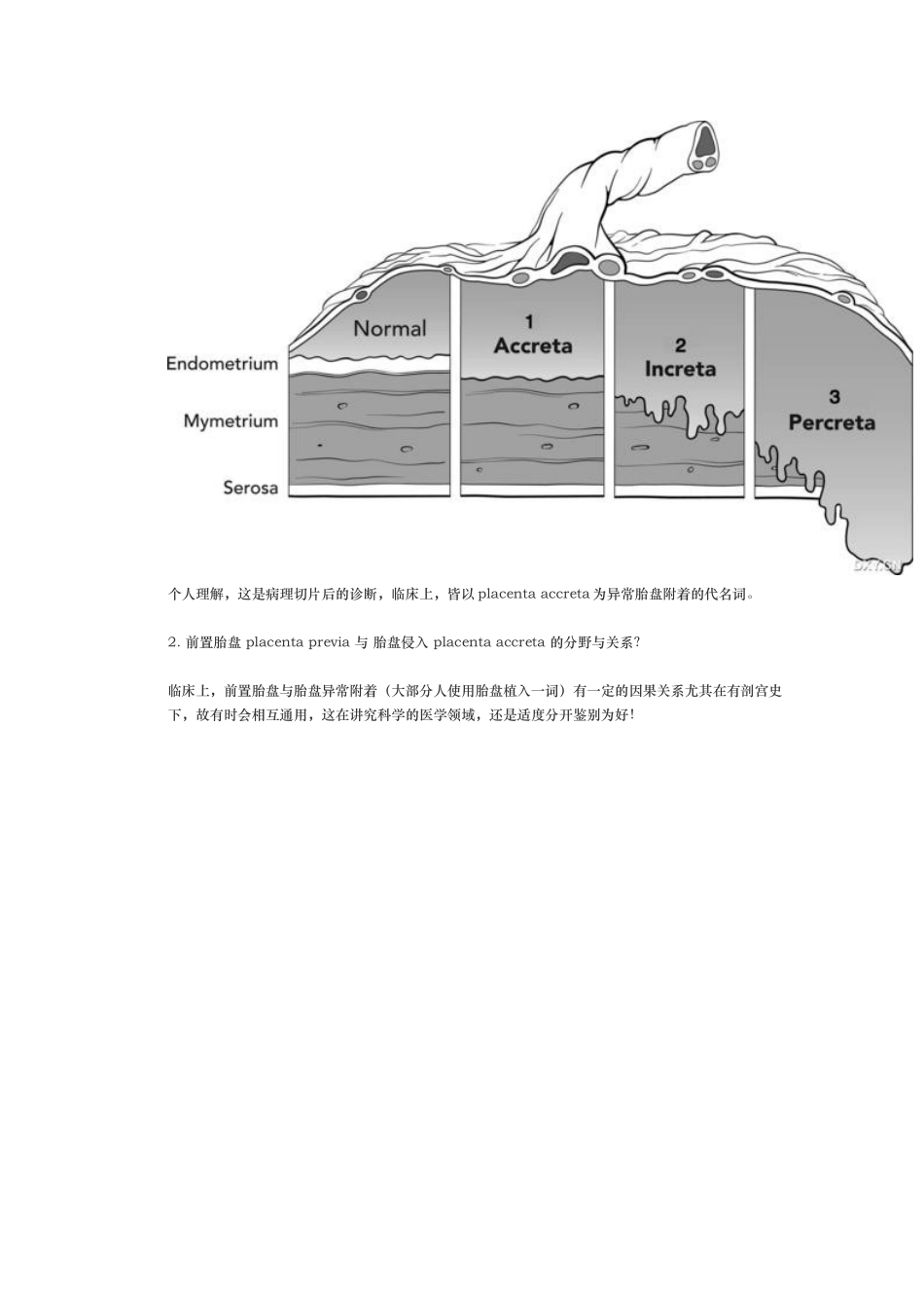 前置胎盘的麻醉_第3页
