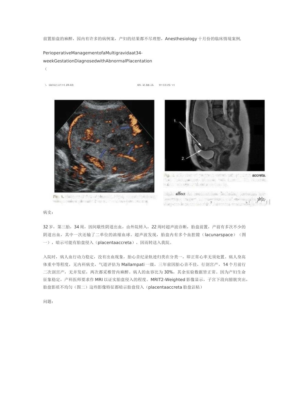 前置胎盘的麻醉汇总_第1页