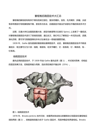 寰枢椎后路内固定术大汇总