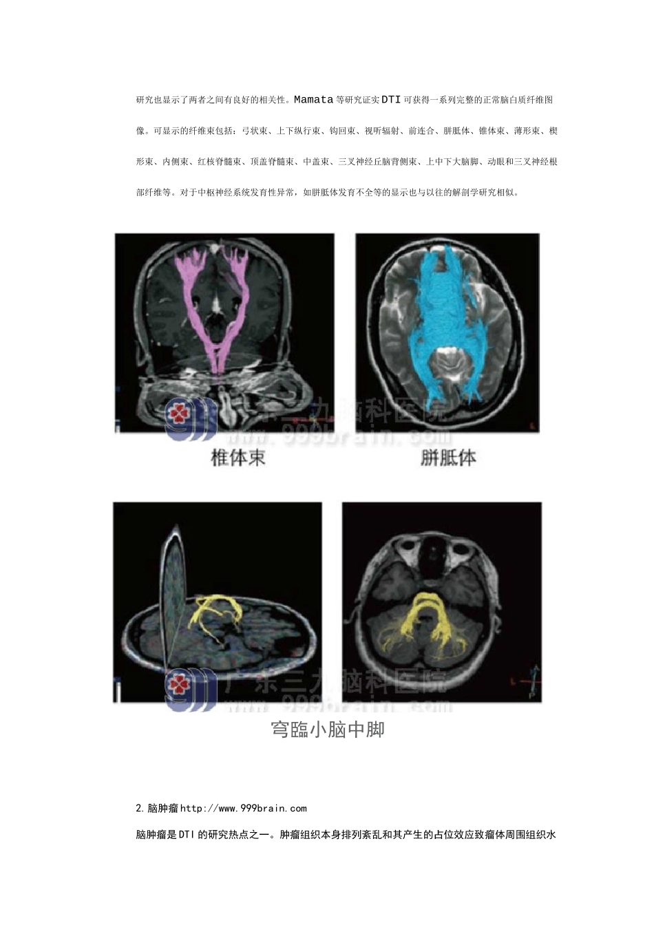 DTI中地FA值_第2页