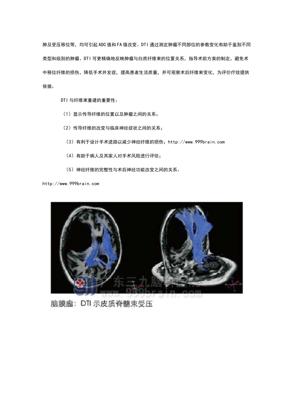 DTI中地FA值_第3页