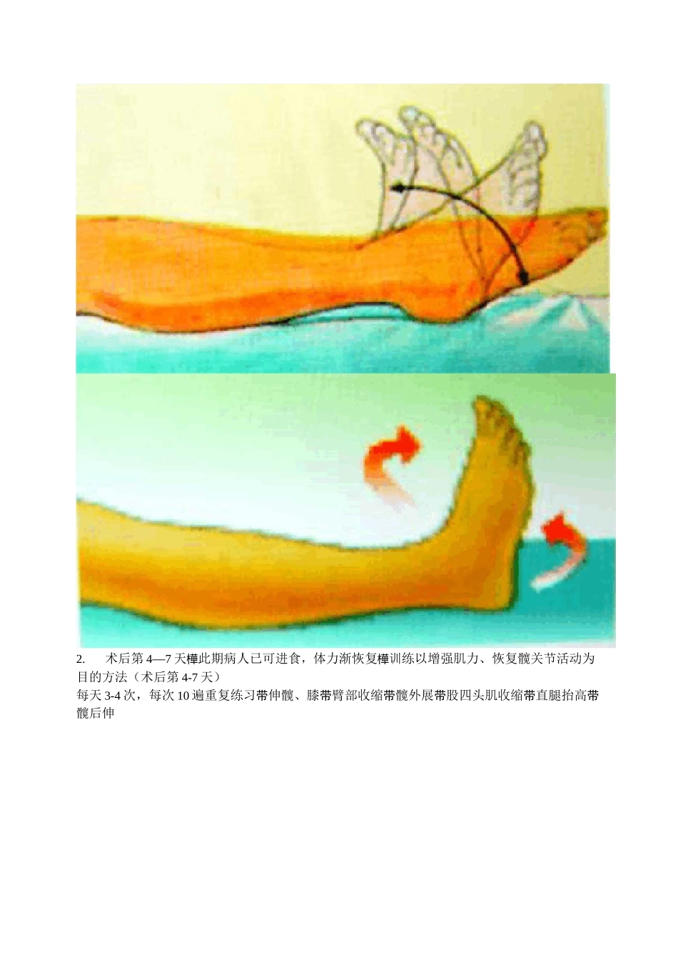 人工髋关节置换术后的康复治疗_第2页