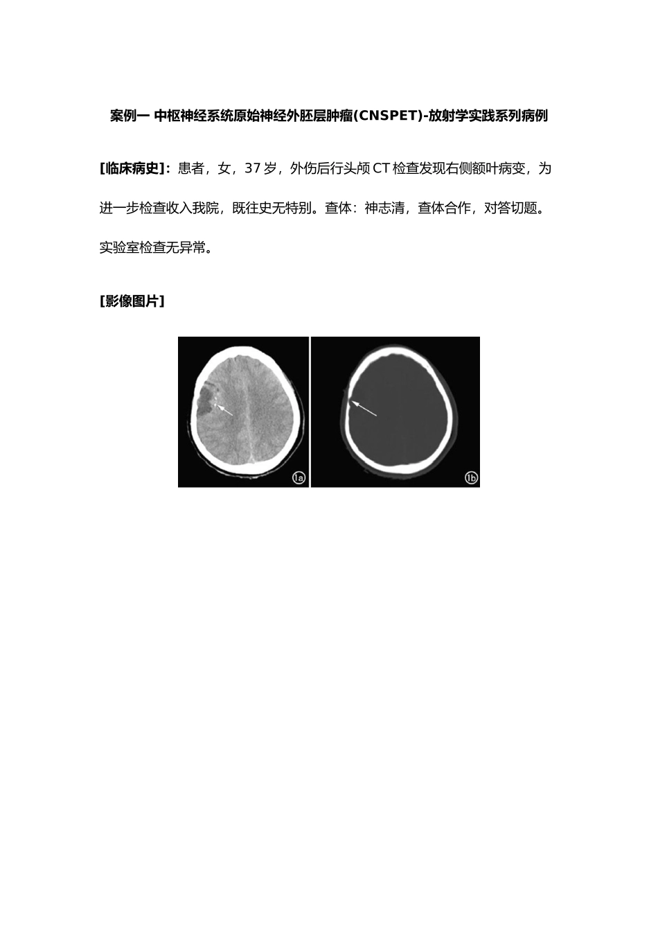 影像诊断学案例_第1页