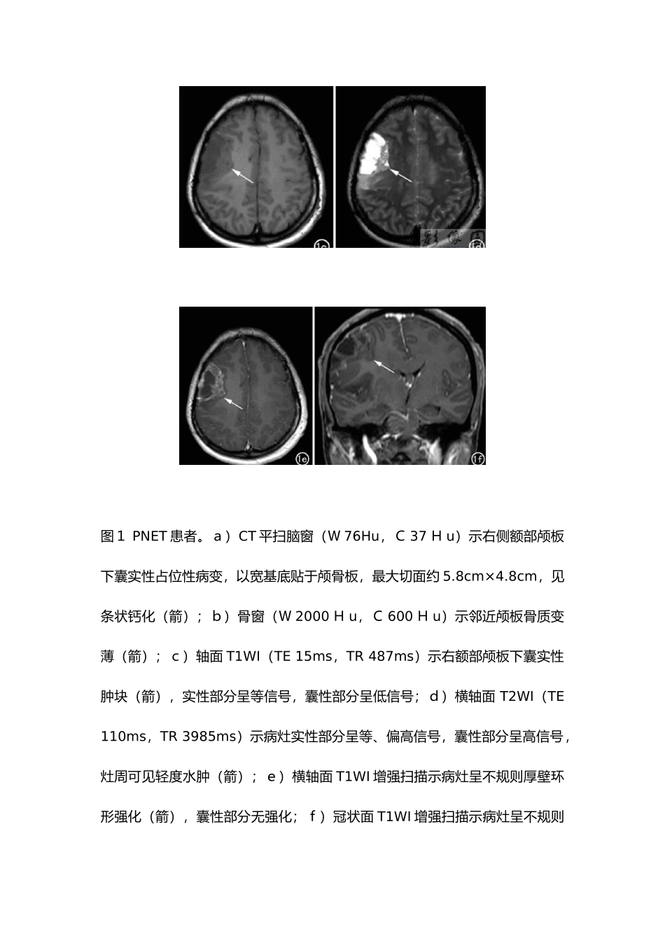影像诊断学案例_第2页