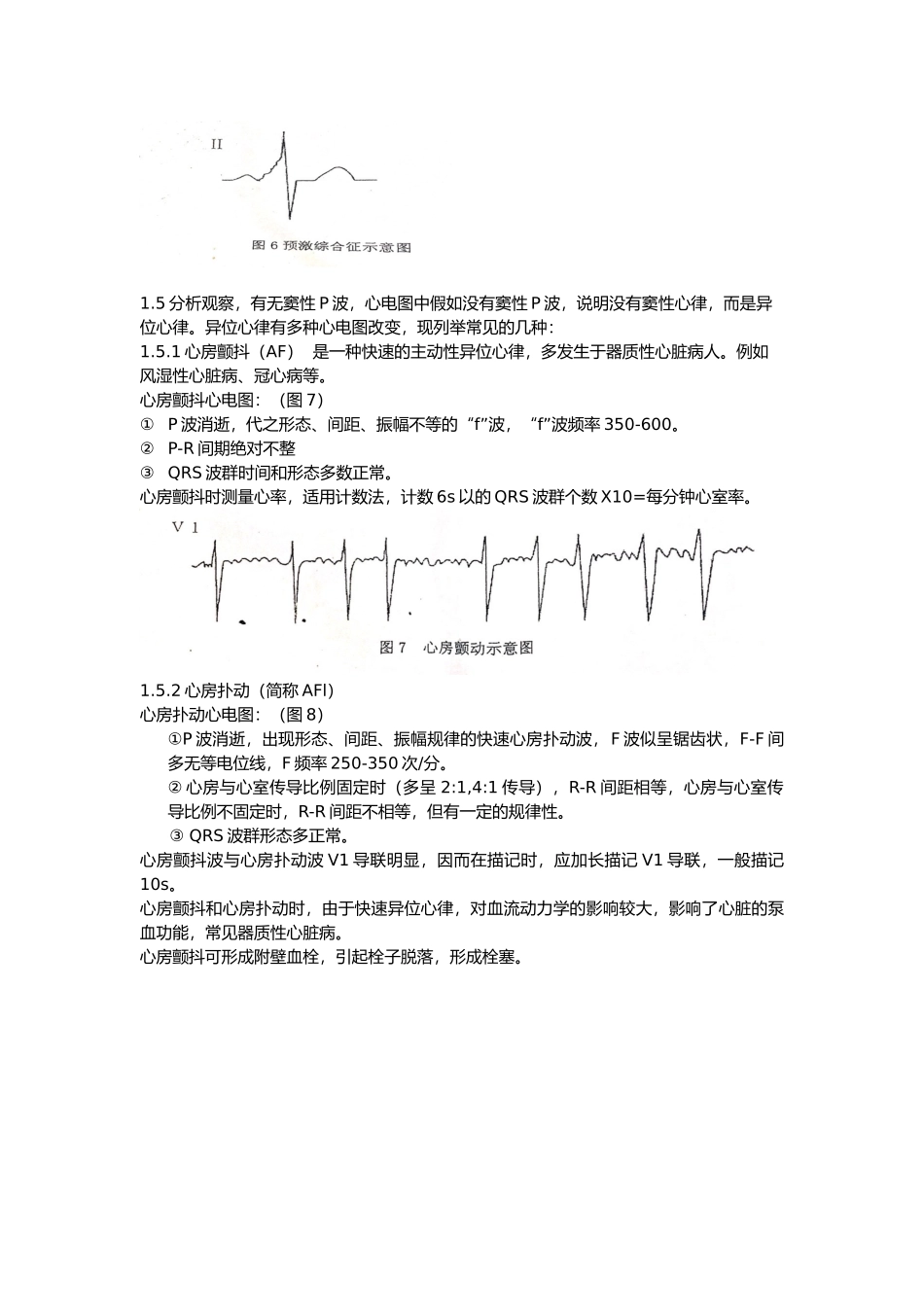 心电图五步分析法_第3页