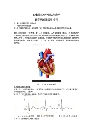 心电图五步分析法