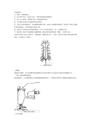 体外循环建立步骤