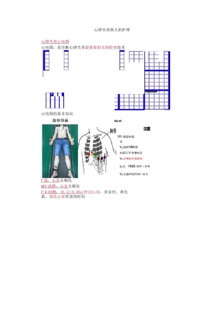 内科护理学-心律失常病人的护理考点汇总