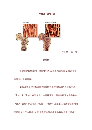 BMD-9超声骨密度参数及报告单说明