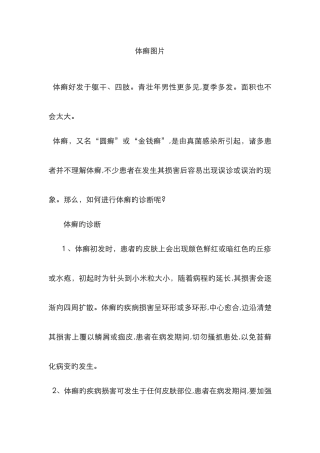 体癣图片新版
