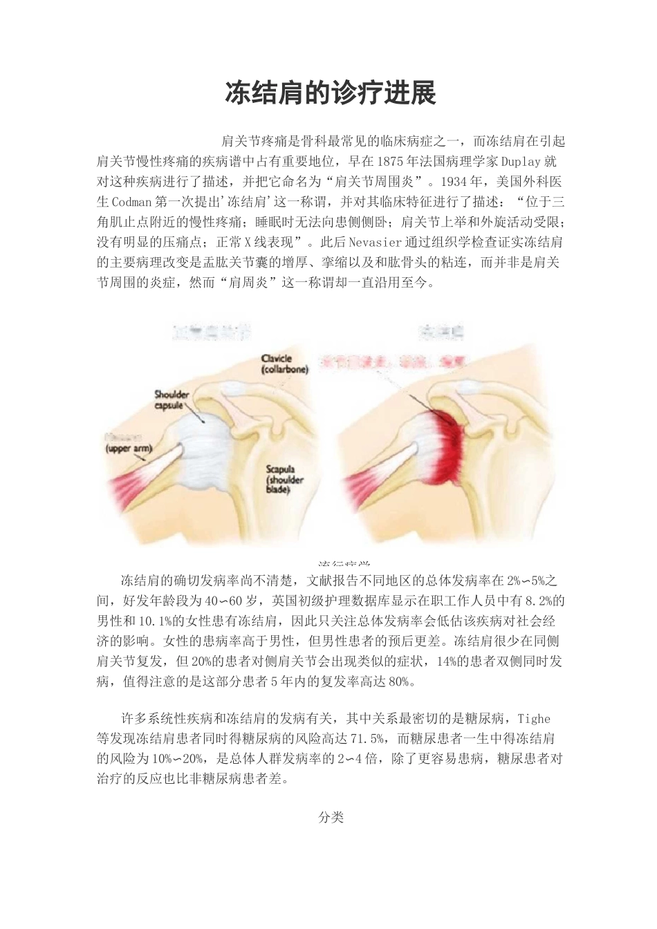冻结肩的诊疗进展_第1页